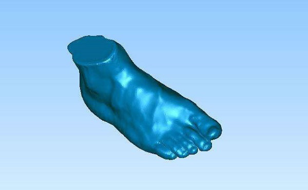 醫(yī)療3D打印機(jī)定制矯正器(圖4) 醫(yī)療3D打印機(jī)定制矯正器(圖4)