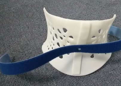 醫(yī)療3D打印機(jī)定制矯正器(圖2) 醫(yī)療3D打印機(jī)定制矯正器(圖2)
