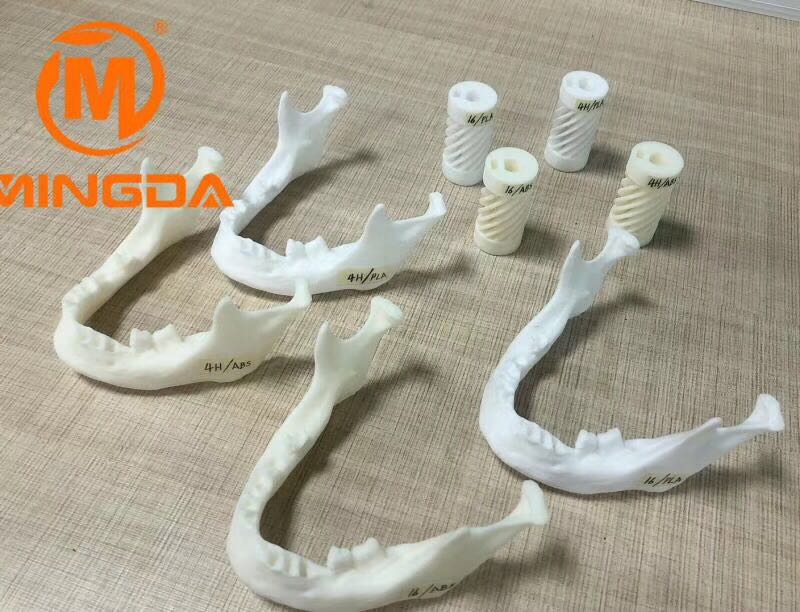 工業(yè)級(jí)3D打印機(jī)在牙科行業(yè)的應(yīng)用(圖1) 工業(yè)級(jí)3D打印機(jī)在牙科行業(yè)的應(yīng)用(圖1)