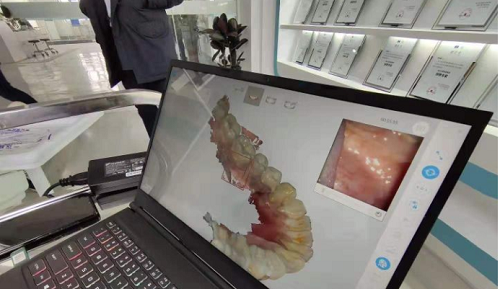  3D打印技術(shù)在牙科義齒領(lǐng)域中牙套制作的應(yīng)用是怎樣的呢？(圖2)